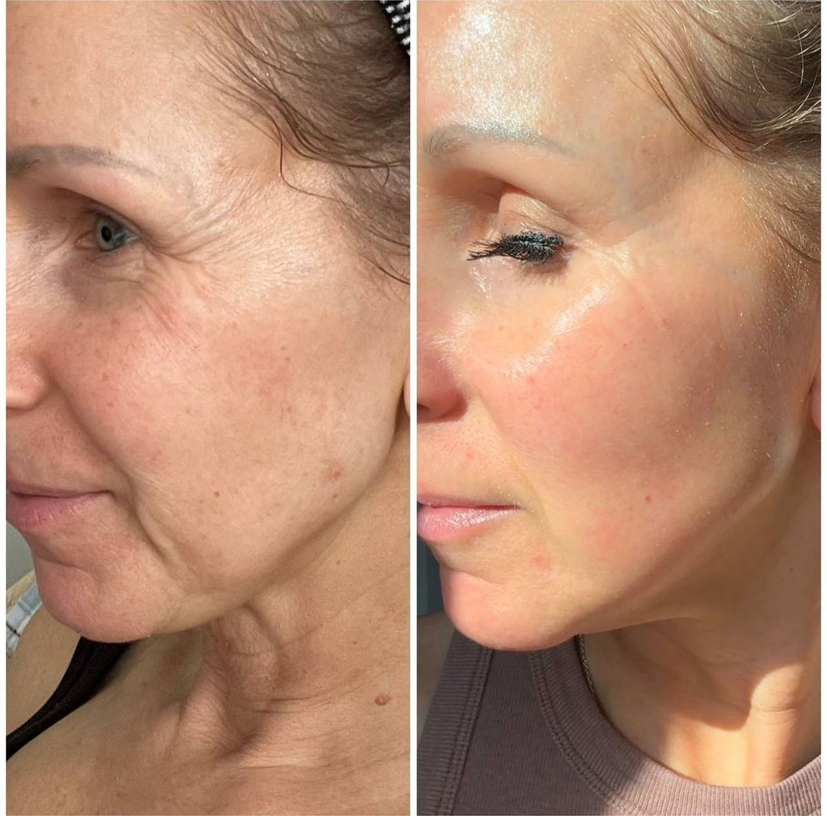Viwella Creme | Verjüngende und feuchtigkeitsspendende koreanische All-in-One-Hautpflege